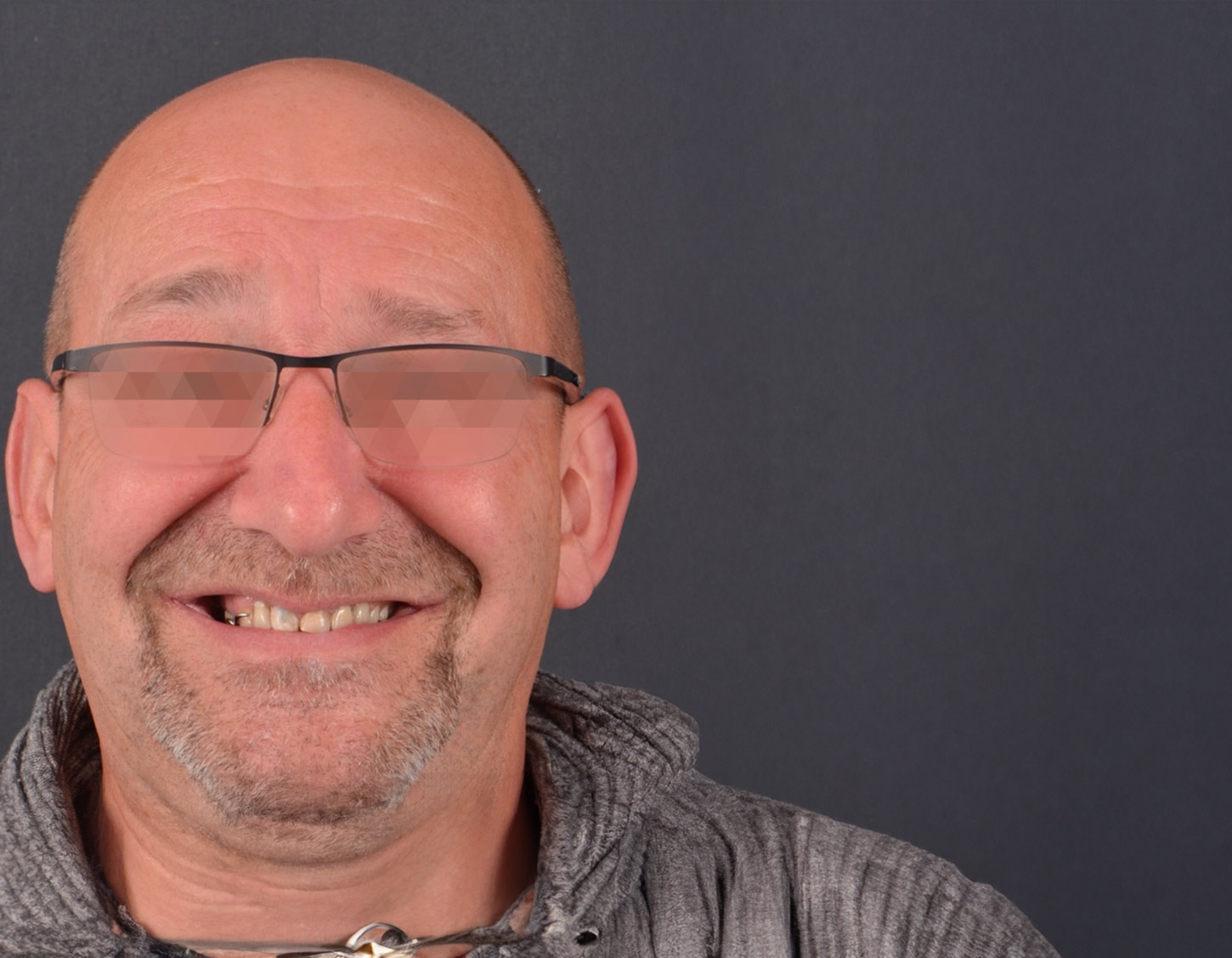 chico-antes-de-cambiar-dientes