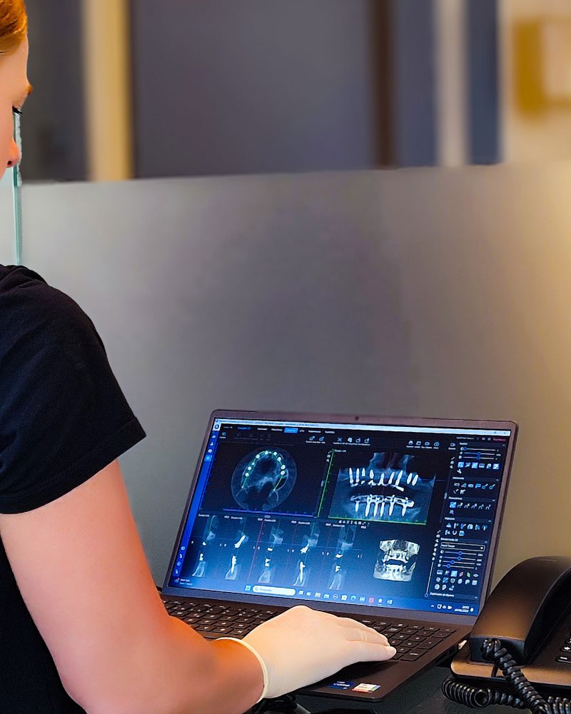 monitoreando-dientes